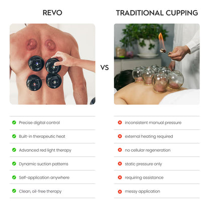 SmartCupp™ Vacuum Cupping Massage