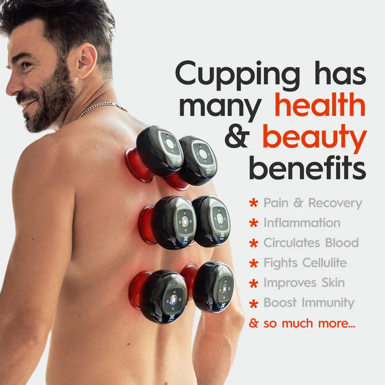 SmartCupp™ Vacuum Cupping Massage