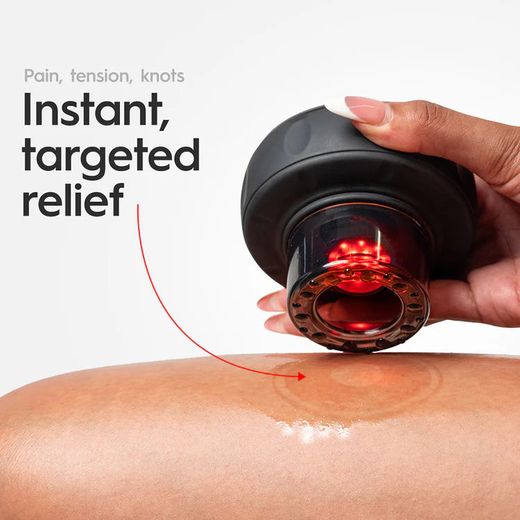 SmartCupp™ Vacuum Cupping Massage