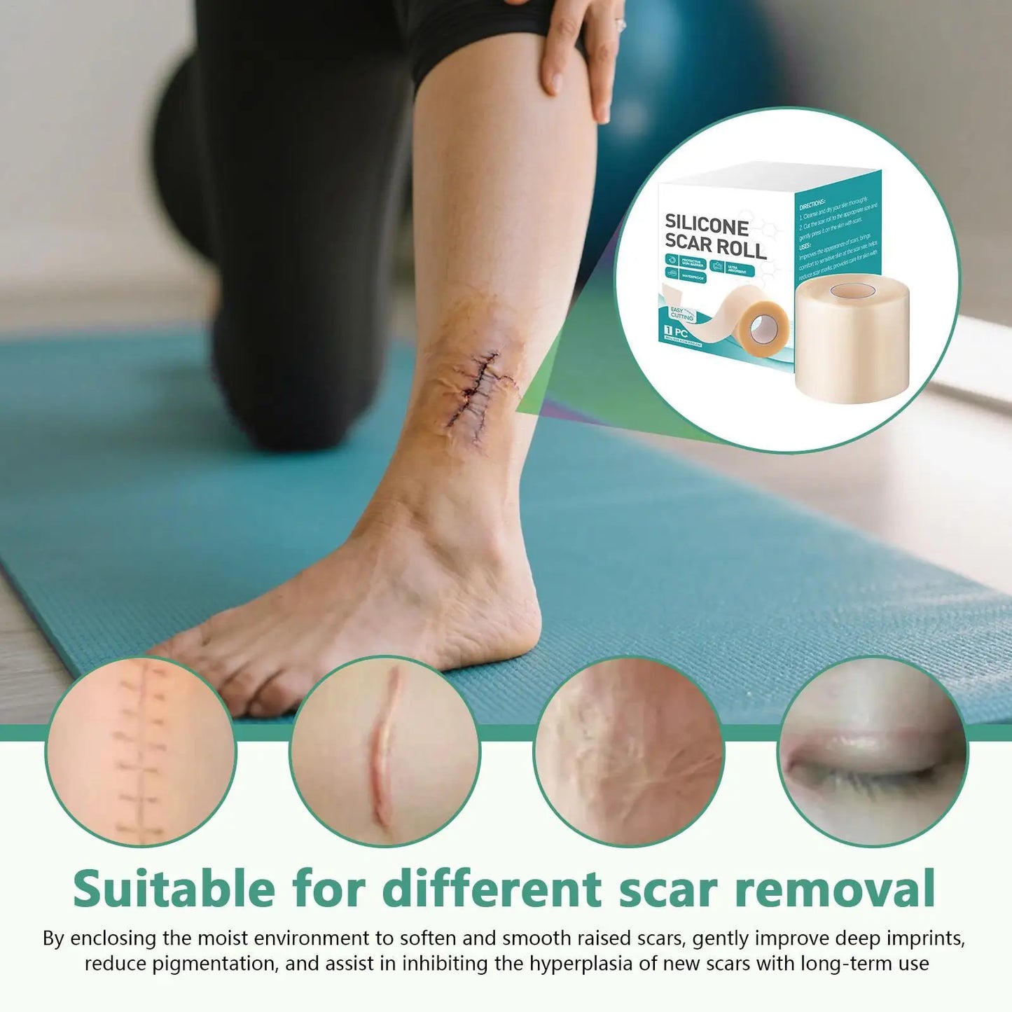 Silicone scar rolls