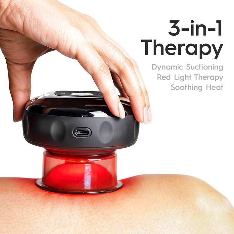 SmartCupp™ Vacuum Cupping Massage